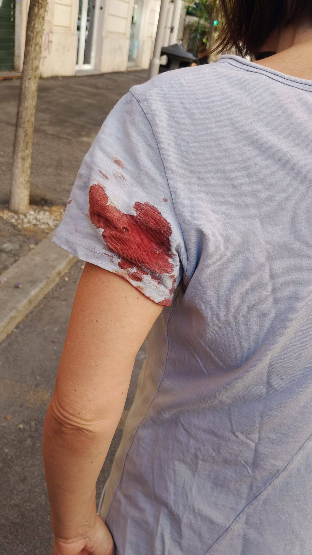 Roma – Passeggia in via della Giuliana e le sparano, Cristina Stillitano ferita da un proiettile vagante nei pressi del Vaticano