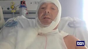 Legale ustionato da acido lanciato da una cliente, arrestata la donna