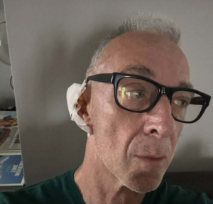 Linus di Radio Deejay annuncia sui social: “Ho un tumore della pelle”. L’avviso ai fan e le caratteristiche dell’epitelioma